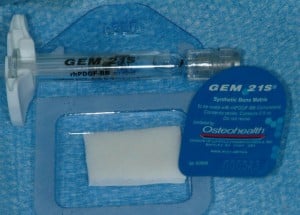 equipment using for periodontal plastic surgery