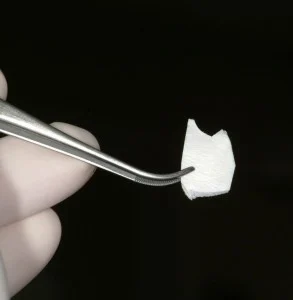 equipment using for periodontal plastic surgery