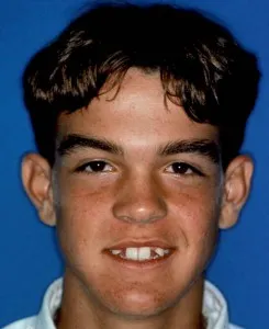 Antes de cirugía de implantes, dos dientes frontales ausentes