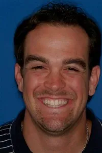 Después de cirugía de implantes, dos dientes frontales ausentes