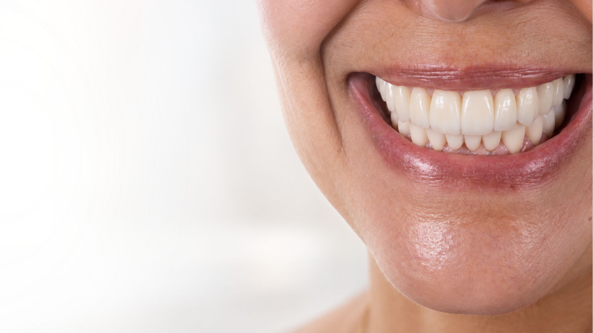 Natural smile after advanced dental treatment at Love Your Jaws oral surgery center in Miami, FL.